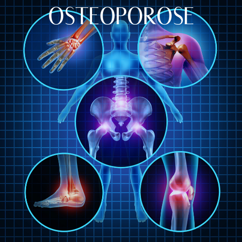 OSTEOPOROSE